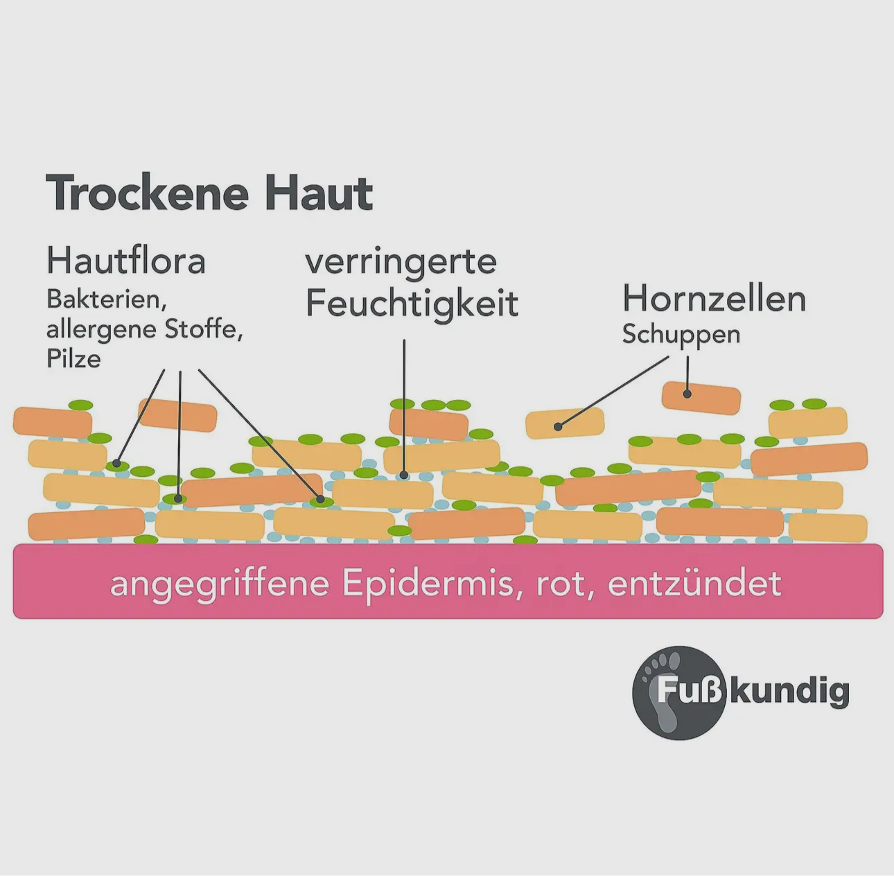 Fuß-Spezial Pflegeschaum gegen Hornhaut & Schrunden 150ml