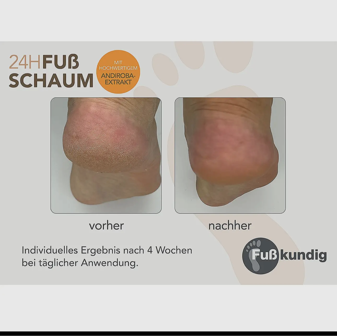 24-h Fussschaum Pflegeschaum 150ml